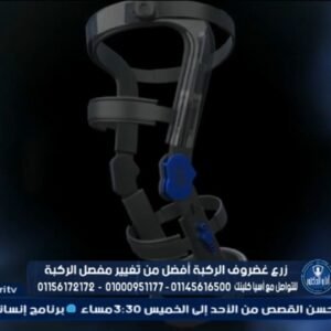 الدعامة الذكية مفصل خارجي