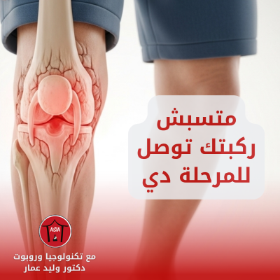 الدرجة الرابعة من خشونة الركبة