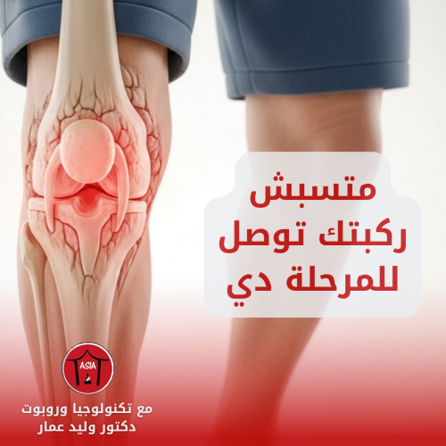 الدرجة الرابعة من خشونة الركبة