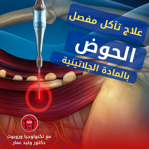 تآكل مفصل الحوض: أحدث طرق العلاج بدون جراحة مع د. وليد عمار